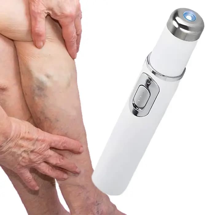 Stylo sans fil pour l'élimination des varices à domicile – Outil de soin des veines pour soulagement