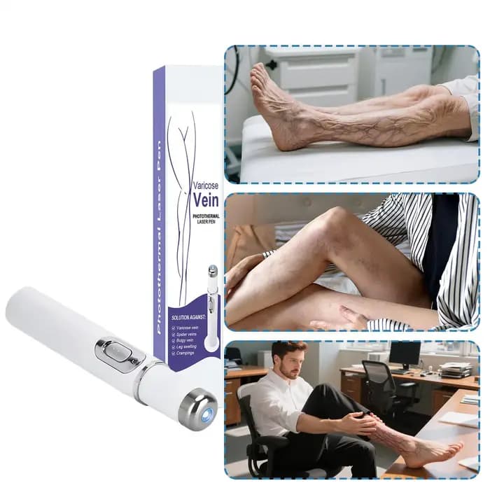 Stylo sans fil pour l'élimination des varices à domicile – Outil de soin des veines pour soulagement quotidien, post-partum et usage nocturne en salon