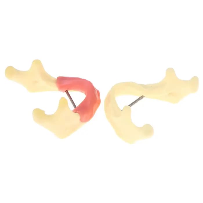 Modèle de traitement dentaire, anatomie des gencives, modèle de tissu Mandible, dentiste, enseignement, étude, démonstration, modèle de dents, laboratoire dentaire