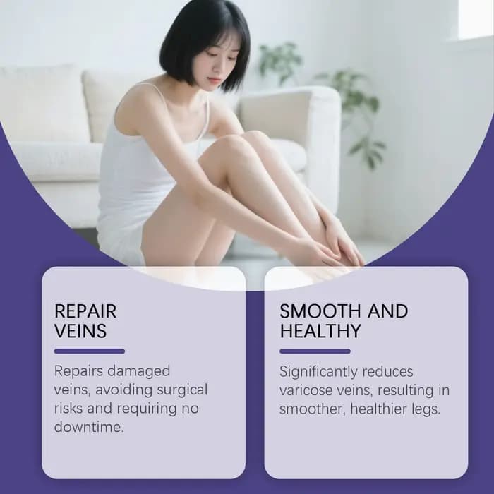 Stylo sans fil pour l'élimination des varices à domicile – Outil de soin des veines pour soulagement quotidien, post-partum et usage nocturne en salon