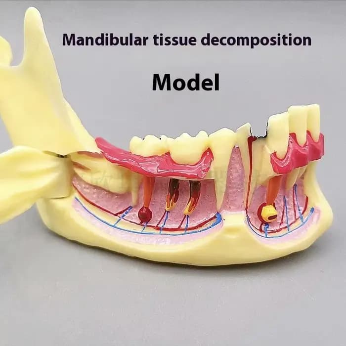Modèle de traitement endodontique dentaire, anatomie des gencives, tissu Mandible, modèle anatomique