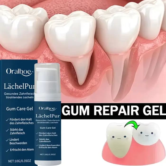 Gel de réparation rapide des gencives, soulage efficacement l'allergie dentaire, carie dentaire, nettoyage des dents, dentifrice, soulage les dommages dentaires, sérum