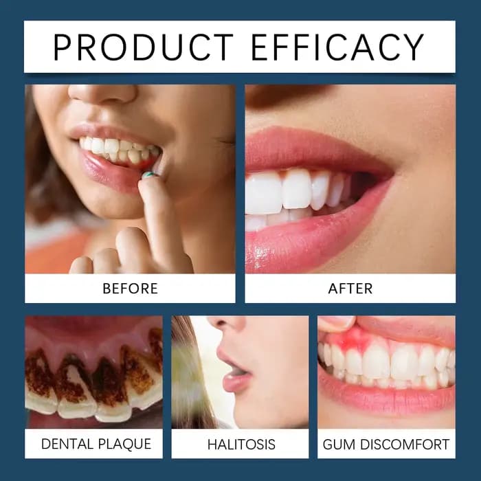 Gel de réparation rapide des gencives, soulage efficacement l'allergie dentaire, carie dentaire, nettoyage des dents, dentifrice, soulage les dommages dentaires, sérum