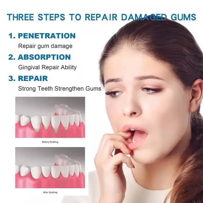Gel de réparation rapide des gencives, soulage efficacement l'allergie dentaire, carie dentaire, nettoyage des dents, dentifrice, soulage les dommages dentaires, sérum